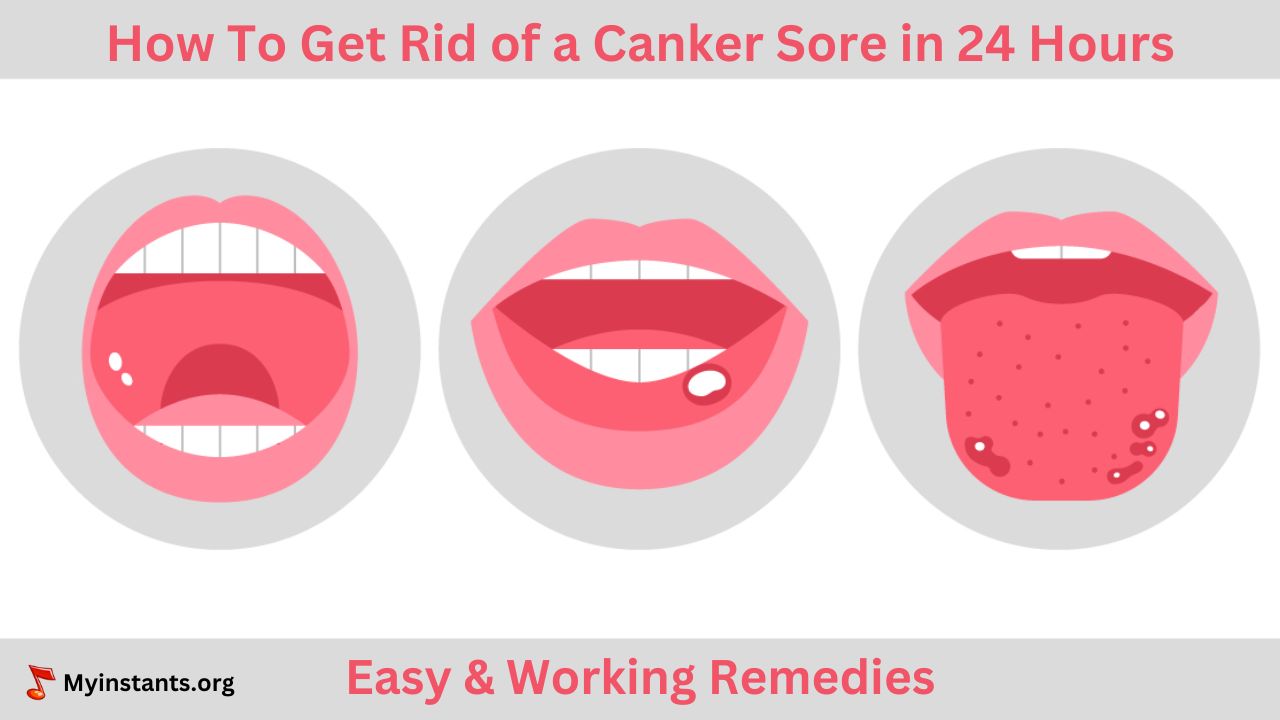 How To Get Rid of a Canker Sore in 24 Hours